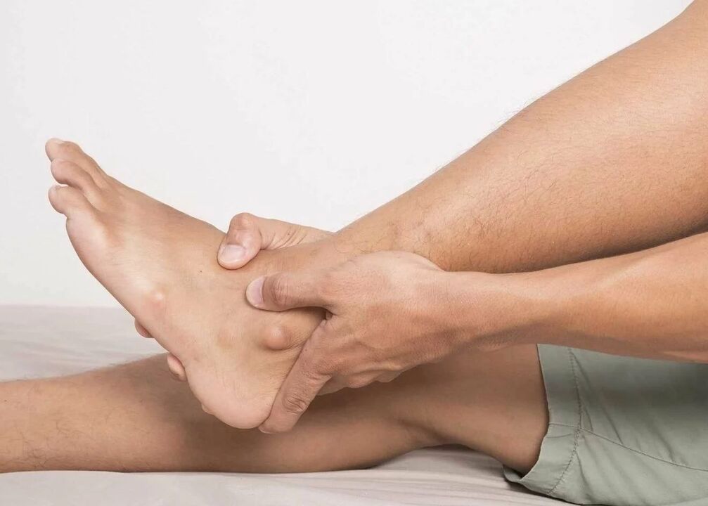 Sintomi dell'artrosi della caviglia