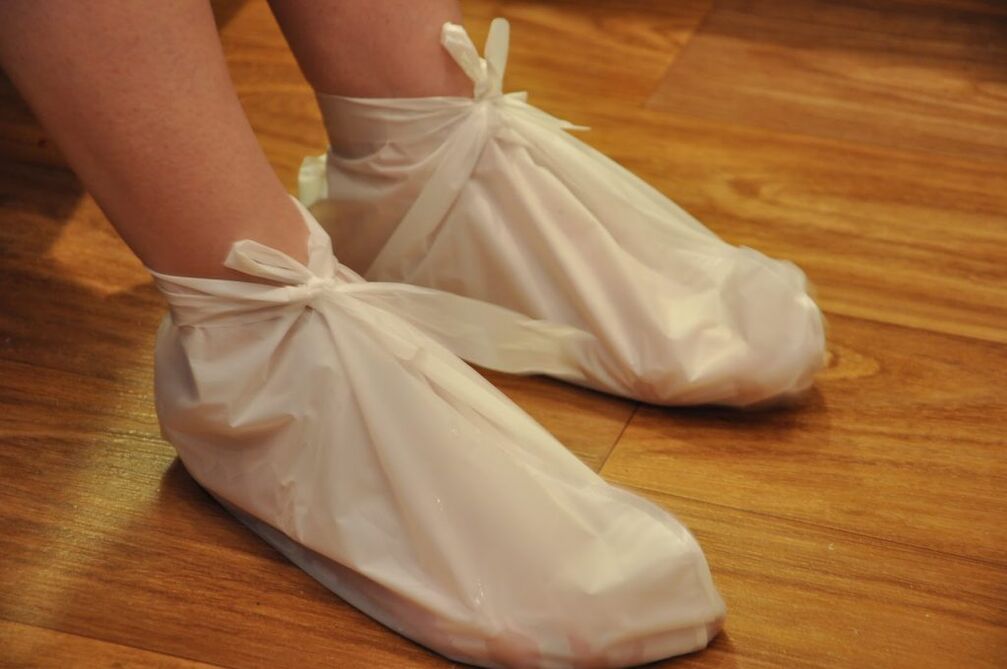 Compresse per artrosi della caviglia