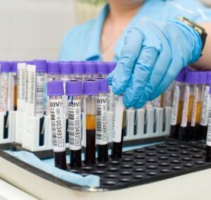 Esame del sangue per diagnosticare il dolore articolare