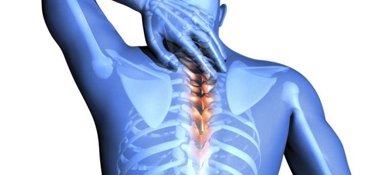 Danni alla colonna vertebrale come causa di dolore tra le scapole